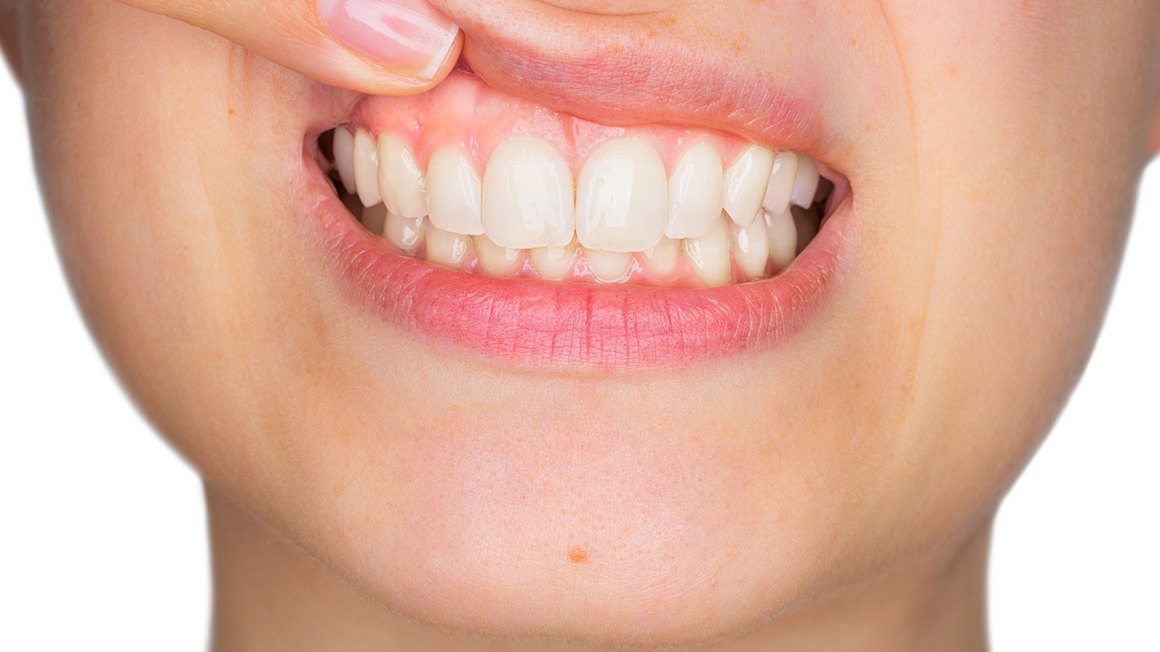 Periodontia em Cascavel