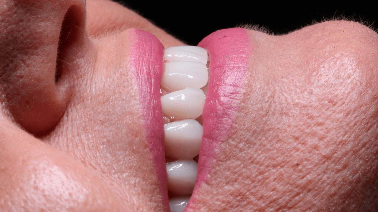 Reabilitação oral · Apóllon Odontologia